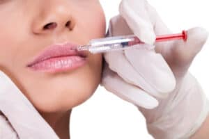 lip augmentation 