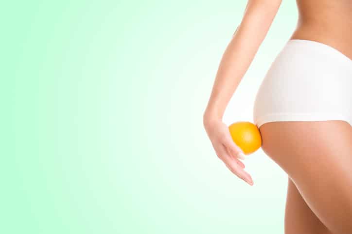 Cellulite Treatment San Francisco CA