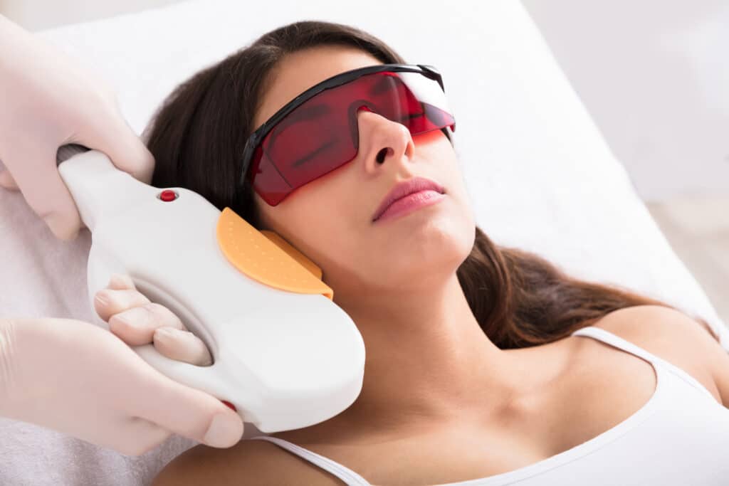 Laser Epilation Treatment On Woman's Chin