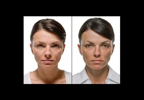 beforeafter1