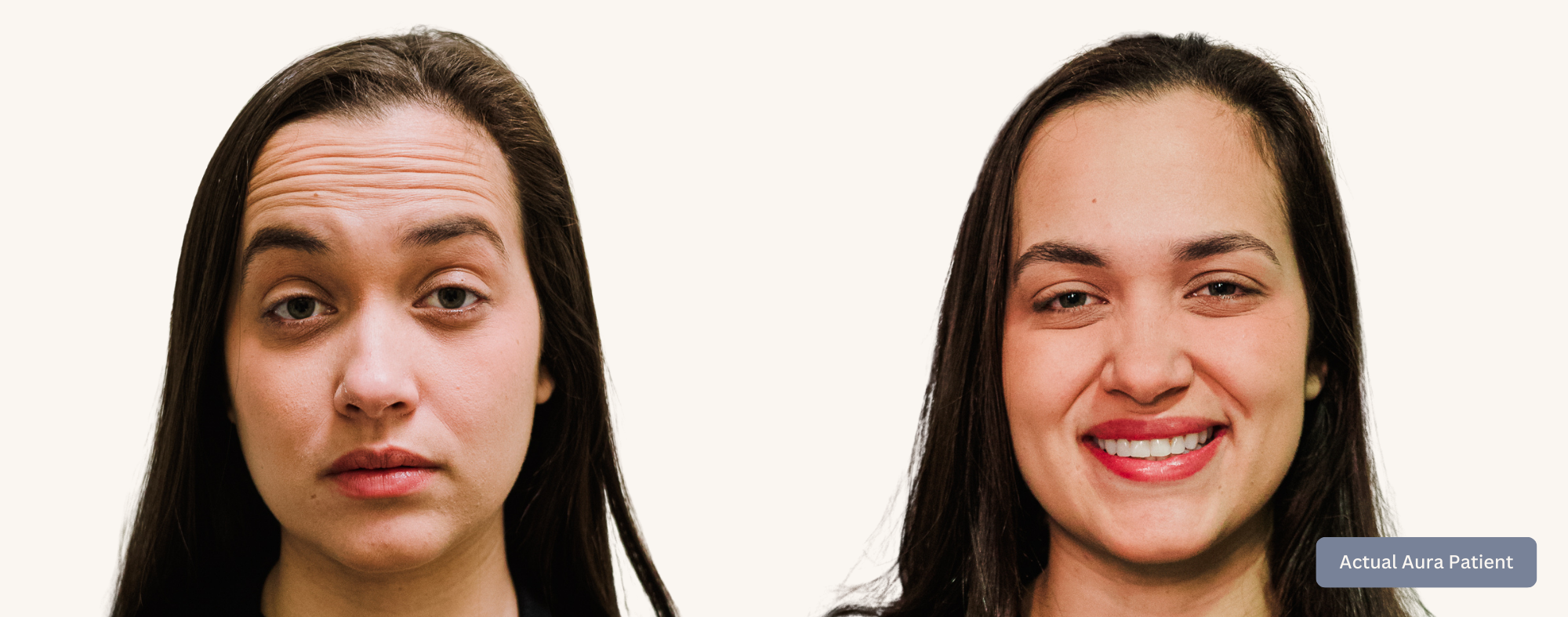 Botox B&A Website