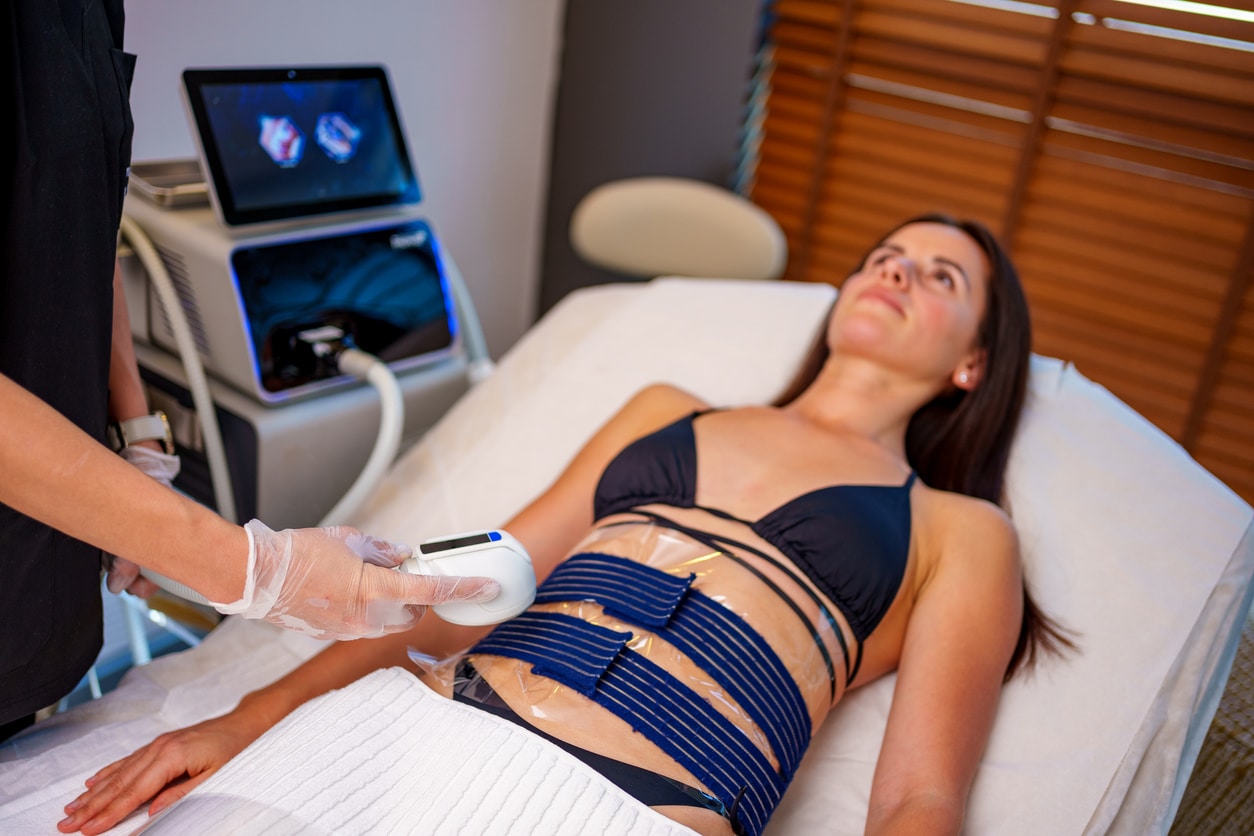A woman receives a non-invasive body contouring treatment in a professional setting. The image shows the patient lying comfortably on a treatment bed, with applicators attached to her abdominal area. A technician operates the advanced control panel of the body contouring machine, adjusting settings to provide a customized experience. This scene highlights modern cosmetic procedures for fat reduction, body shaping, and wellness, using state-of-the-art technology. Ideal for topics related to health, beauty, and aesthetic treatment innovations.