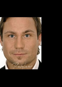After Image: Restylane® Patient 2 - front